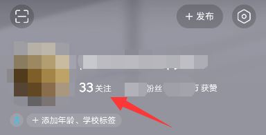 頭條如何添加抖音好友？